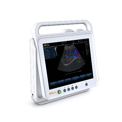 PT50C Touch Color Doppler Ultrasound Scanner System - Image 3