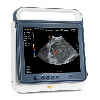 PT50C Touch Color Doppler Ultrasound Scanner System - Image 2
