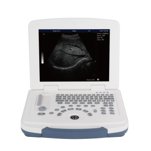 Ultrasound Portable Black and 
White MAS-580
