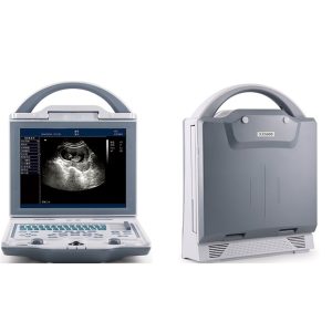 Rechargeable Human Ultrasound Scanner -KX5600