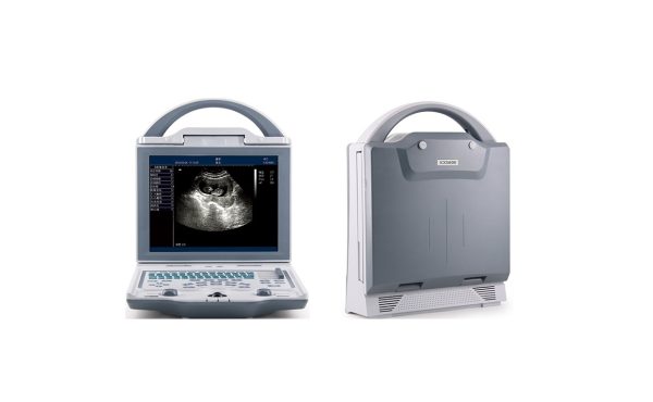 Rechargeable Human Ultrasound Scanner -KX5600 - Image 2