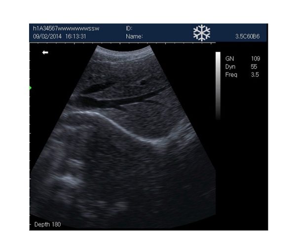 Rechargeable Human Ultrasound Scanner -KX5600 - Image 5