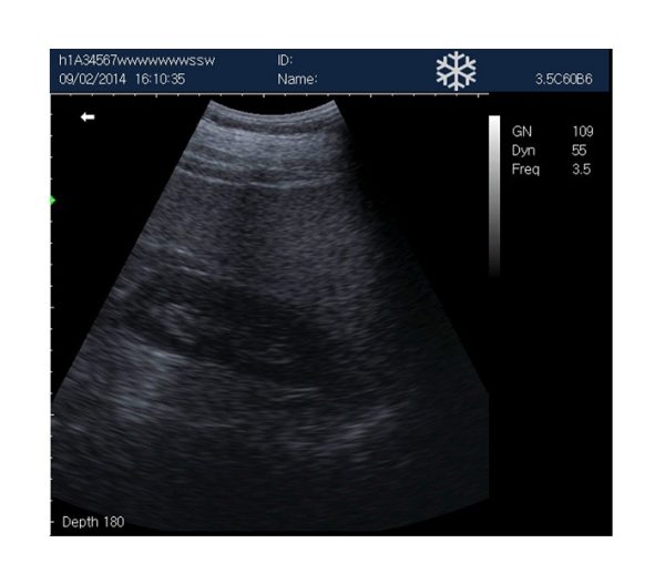 Rechargeable Human Ultrasound Scanner -KX5600 - Image 6