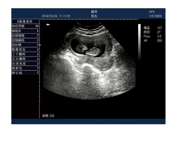 Rechargeable Human Ultrasound Scanner -KX5600 - Image 7