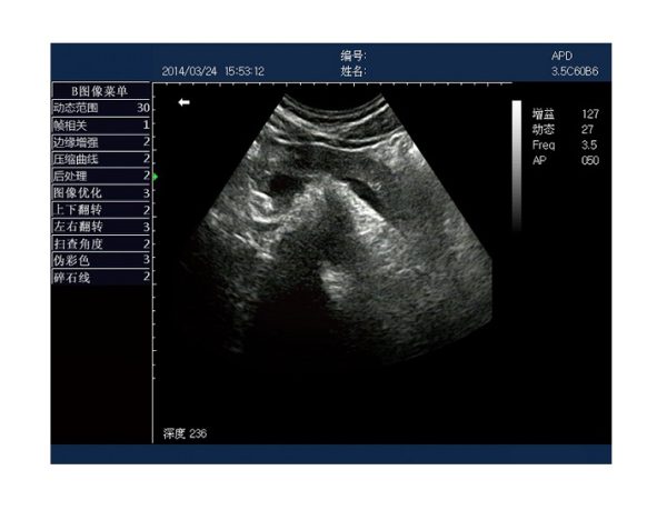 Rechargeable Human Ultrasound Scanner -KX5600 - Image 8