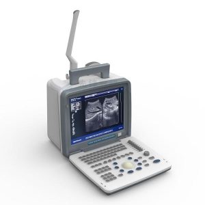 Portable LED screen ultrasound