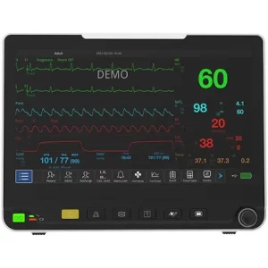 wrist vital sign monitor