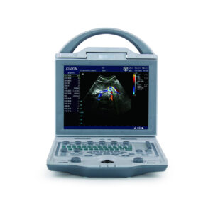 Portable Color Doppler Ultrasound DCU-12