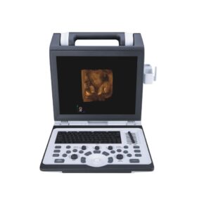 Apogee 2100 Ultrasound Machine