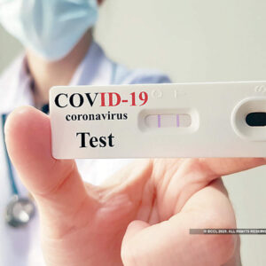 Alinity m SARS-CoV-2 AMP Kit