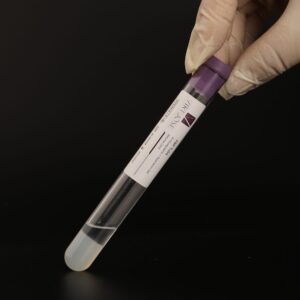 PRP Tubes