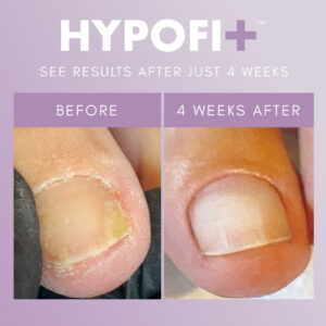 HypoFix Repair Serum 20ML